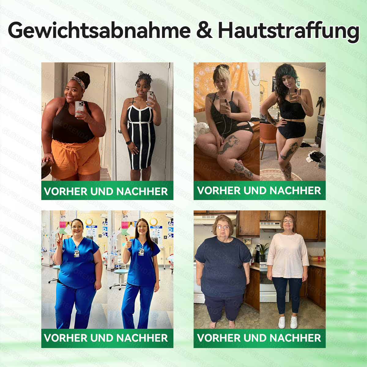 🇦🇹𝐎𝐟𝐟𝐢𝐳𝐢𝐞𝐥𝐥𝐞𝐫 𝐒𝐡𝐨𝐩 | 🩹💃 𝑮𝑳𝑶𝐑𝐄𝐍𝐃𝘼®𝙈𝙤𝙧𝙞𝙣𝗴𝗮 · 𝗕𝗲𝗿𝗯𝗲𝗿𝒊𝒏 × 𝑵𝘼𝘿+ 10-𝙞𝙣-𝟏 𝐀𝐝𝐯𝐚𝗻𝗰𝗲𝗱 𝗡𝗮𝙣𝙤 𝙈𝙞𝙠𝙧𝐨𝐧𝐚𝐝𝐞𝐥-𝐏𝐚𝒕𝒄𝗵(𝐍𝐮𝐫 𝐞𝐢𝐧𝐦𝐚𝐥 𝐭ä𝐠𝐥𝐢𝐜𝐡, 𝐬𝐢𝐜𝐡𝐭𝐛𝐚𝐫𝐞 𝐕𝐞𝐫ä𝐧𝐝𝐞𝐫𝐮𝐧𝐠𝐞𝐧 𝐢𝐧 𝟕 𝐓𝐚𝐠𝐞𝐧)✅ 𝐅ü𝐫 𝐅𝐞𝐭𝐭𝐥𝐞𝐢𝐛𝐢𝐠𝐤𝐞𝐢𝐭, 𝐇𝐚𝐮𝐭𝐬𝐭𝐫𝐚𝐟𝐟𝐮𝐧𝐠, 𝐃𝐢𝐚𝐛𝐞𝐭𝐞𝐬, 𝐒𝐜𝐡𝐥𝐚𝐟𝐚𝐩𝐧𝐨𝐞, 𝐆𝐞𝐥𝐞𝐧𝐤𝐩𝐫𝐨𝐛𝐥𝐞𝐦𝐞 𝐮𝐧𝐝 𝐦𝐞𝐡𝐫!