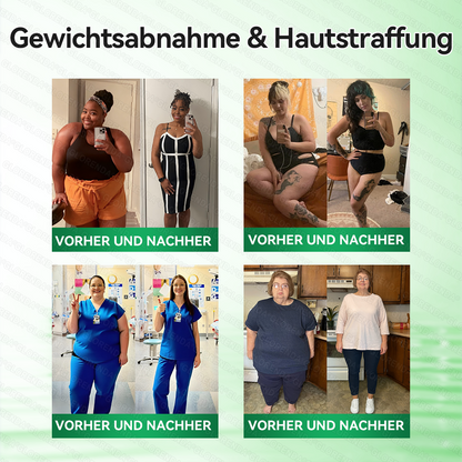 🇩🇪𝐎𝐟𝐟𝐢𝐳𝐢𝐞𝐥𝐥𝐞𝐫 𝐒𝐡𝐨𝐩 | 🩹🌞 𝑮𝑳𝑶𝐑𝐄𝐍𝐃𝘼®𝙈𝙤𝙧𝙞𝙣𝗴𝗮 · 𝗕𝗲𝗿𝗯𝗲𝗿𝒊𝒏 × 𝑵𝘼𝘿+ 10-𝙞𝙣-𝟏 𝐀𝐝𝐯𝐚𝗻𝗰𝗲𝗱 𝗡𝗮𝙣𝙤 𝙈𝙞𝙠𝙧𝐨𝐧𝐚𝐝𝐞𝐥-𝐏𝐚𝒕𝒄𝗵(𝐍𝐮𝐫 𝐞𝐢𝐧𝐦𝐚𝐥 𝐭ä𝐠𝐥𝐢𝐜𝐡, 𝐬𝐢𝐜𝐡𝐭𝐛𝐚𝐫𝐞 𝐕𝐞𝐫ä𝐧𝐝𝐞𝐫𝐮𝐧𝐠𝐞𝐧 𝐢𝐧 𝟕 𝐓𝐚𝐠𝐞𝐧)✅ 𝐅ü𝐫 𝐅𝐞𝐭𝐭𝐥𝐞𝐢𝐛𝐢𝐠𝐤𝐞𝐢𝐭, 𝐇𝐚𝐮𝐭𝐬𝐭𝐫𝐚𝐟𝐟𝐮𝐧𝐠, 𝐃𝐢𝐚𝐛𝐞𝐭𝐞𝐬, 𝐒𝐜𝐡𝐥𝐚𝐟𝐚𝐩𝐧𝐨𝐞, 𝐆𝐞𝐥𝐞𝐧𝐤𝐩𝐫𝐨𝐛𝐥𝐞𝐦𝐞 𝐮𝐧𝐝 𝐦𝐞𝐡𝐫!