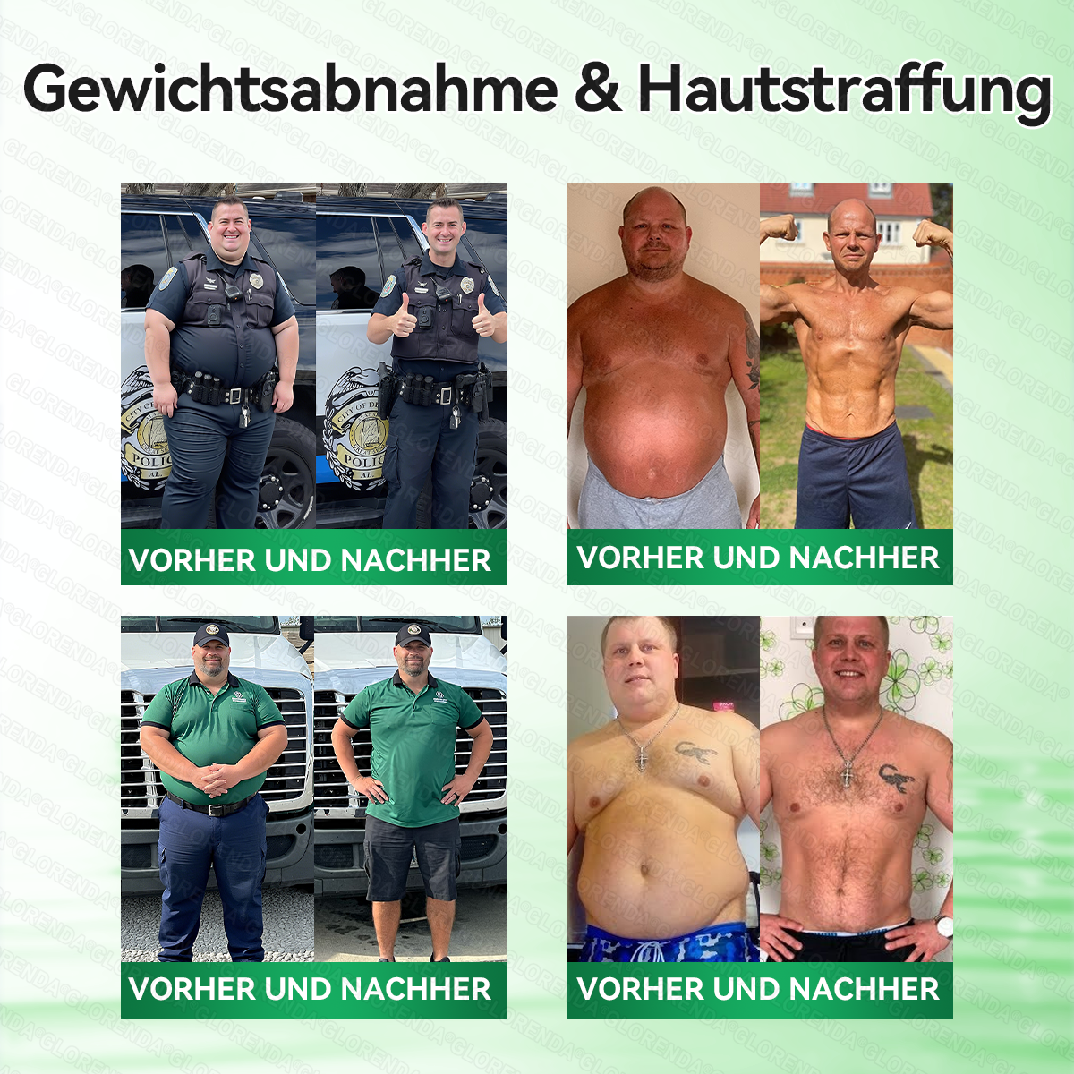 🇩🇪𝐎𝐟𝐟𝐢𝐳𝐢𝐞𝐥𝐥𝐞𝐫 𝐒𝐡𝐨𝐩 | 🩹🌞 𝑮𝑳𝑶𝐑𝐄𝐍𝐃𝘼®𝙈𝙤𝙧𝙞𝙣𝗴𝗮 · 𝗕𝗲𝗿𝗯𝗲𝗿𝒊𝒏 × 𝑵𝘼𝘿+ 10-𝙞𝙣-𝟏 𝐀𝐝𝐯𝐚𝗻𝗰𝗲𝗱 𝗡𝗮𝙣𝙤 𝙈𝙞𝙠𝙧𝐨𝐧𝐚𝐝𝐞𝐥-𝐏𝐚𝒕𝒄𝗵(𝐍𝐮𝐫 𝐞𝐢𝐧𝐦𝐚𝐥 𝐭ä𝐠𝐥𝐢𝐜𝐡, 𝐬𝐢𝐜𝐡𝐭𝐛𝐚𝐫𝐞 𝐕𝐞𝐫ä𝐧𝐝𝐞𝐫𝐮𝐧𝐠𝐞𝐧 𝐢𝐧 𝟕 𝐓𝐚𝐠𝐞𝐧)✅ 𝐅ü𝐫 𝐅𝐞𝐭𝐭𝐥𝐞𝐢𝐛𝐢𝐠𝐤𝐞𝐢𝐭, 𝐇𝐚𝐮𝐭𝐬𝐭𝐫𝐚𝐟𝐟𝐮𝐧𝐠, 𝐃𝐢𝐚𝐛𝐞𝐭𝐞𝐬, 𝐒𝐜𝐡𝐥𝐚𝐟𝐚𝐩𝐧𝐨𝐞, 𝐆𝐞𝐥𝐞𝐧𝐤𝐩𝐫𝐨𝐛𝐥𝐞𝐦𝐞 𝐮𝐧𝐝 𝐦𝐞𝐡𝐫!